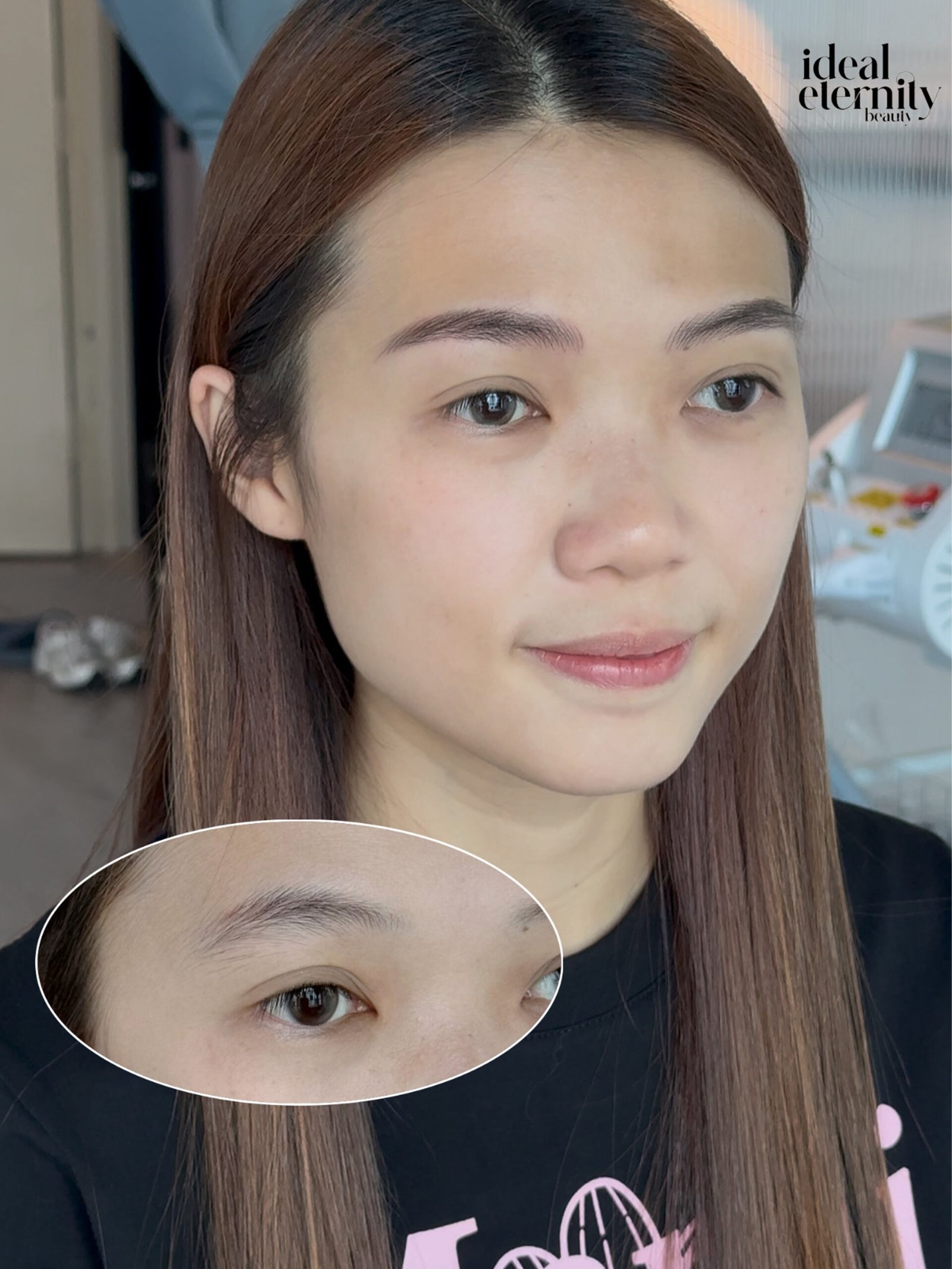 Add on Why choose us 1